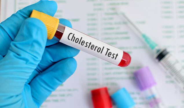 Getting to know the Cholesterol family